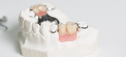 Ortodontia com brackets metálicos