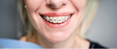 Ortodontia com brackets metálicos